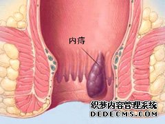 内包皮过长